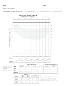 Blank Audiogram Pdf: Fill Out &amp; Sign Online | Dochub within Free Printable Blank Audiogram Template